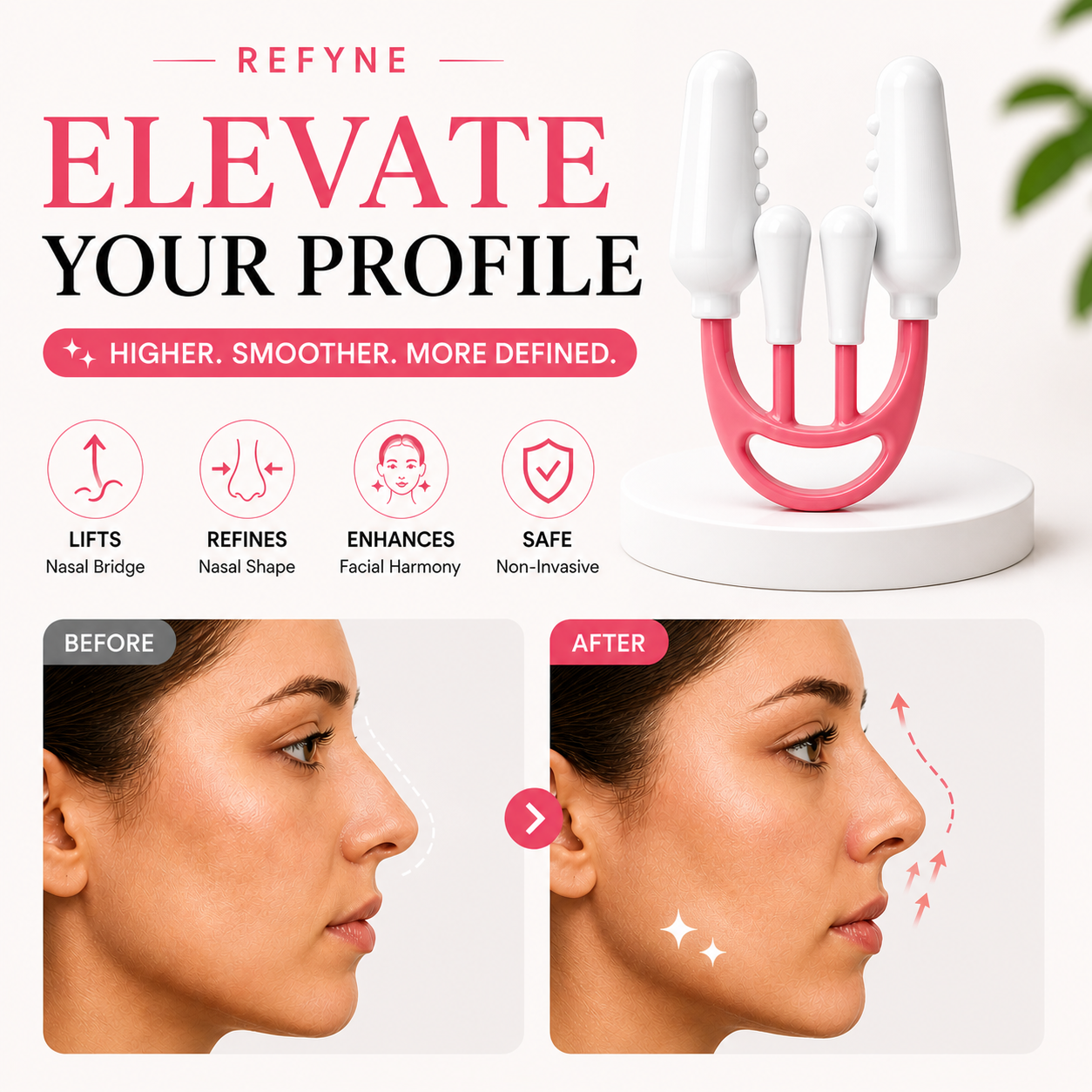 REFYNE™  NOSE SCULPTER